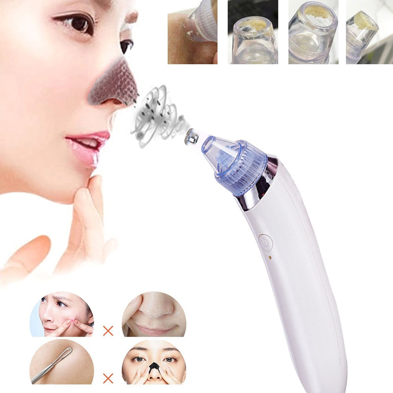 Professional Electric Facial Pore cleaner